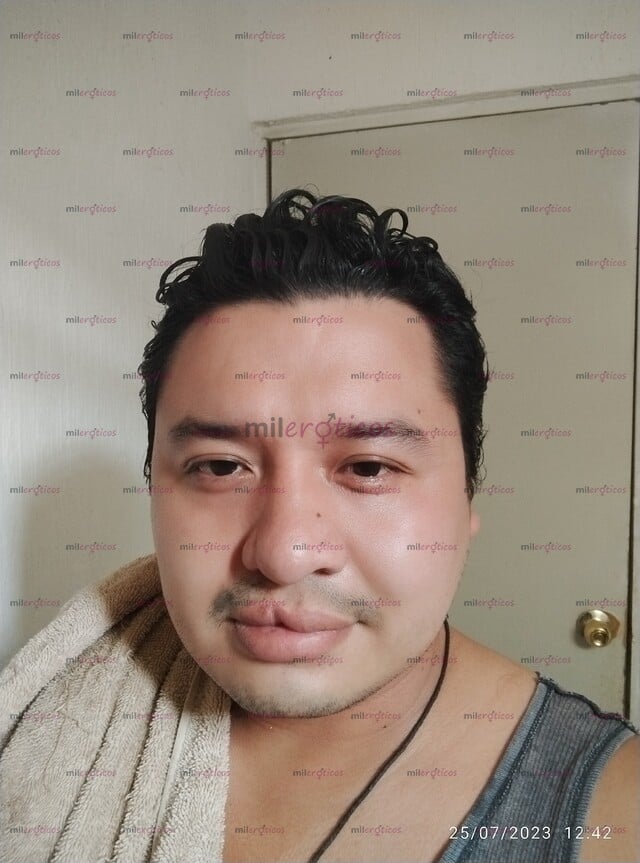 FOTOS DE TENGO PALADAR ENDIDO Y LABIO LEPORINO SI ESO NO AFECTA CONTACTAME