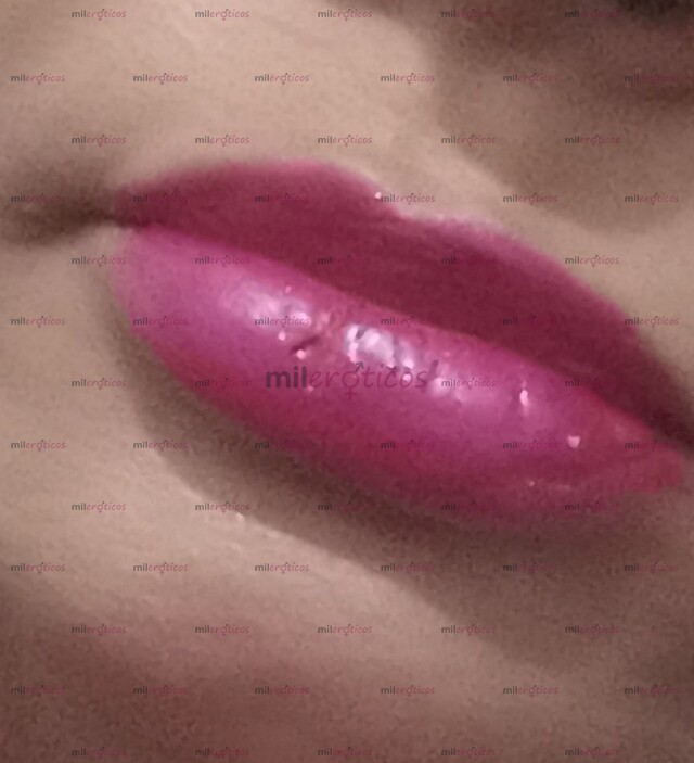 FOTOS DE LIZ,SRA,59,AÑOS,TERAP.MASA120,SERV200,EXT350.ANTES,M.DIEGUEZ ,HOY,ZAPOPAN