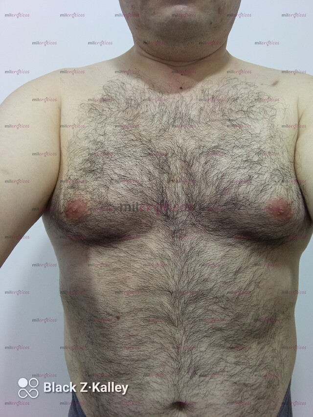 FOTOS DE JUAN ATENCIÓN A MUJERES A DOMICILIO, COMPLETO