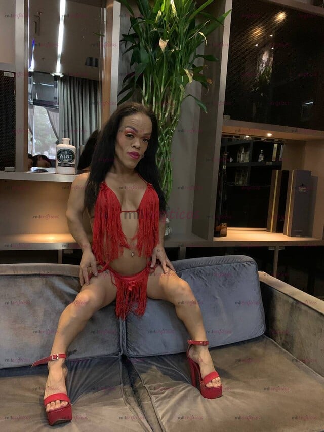 FOTOS DE LA PRIMERA ENANA TRANS BAJITA OPERADA EN COLOMBIA