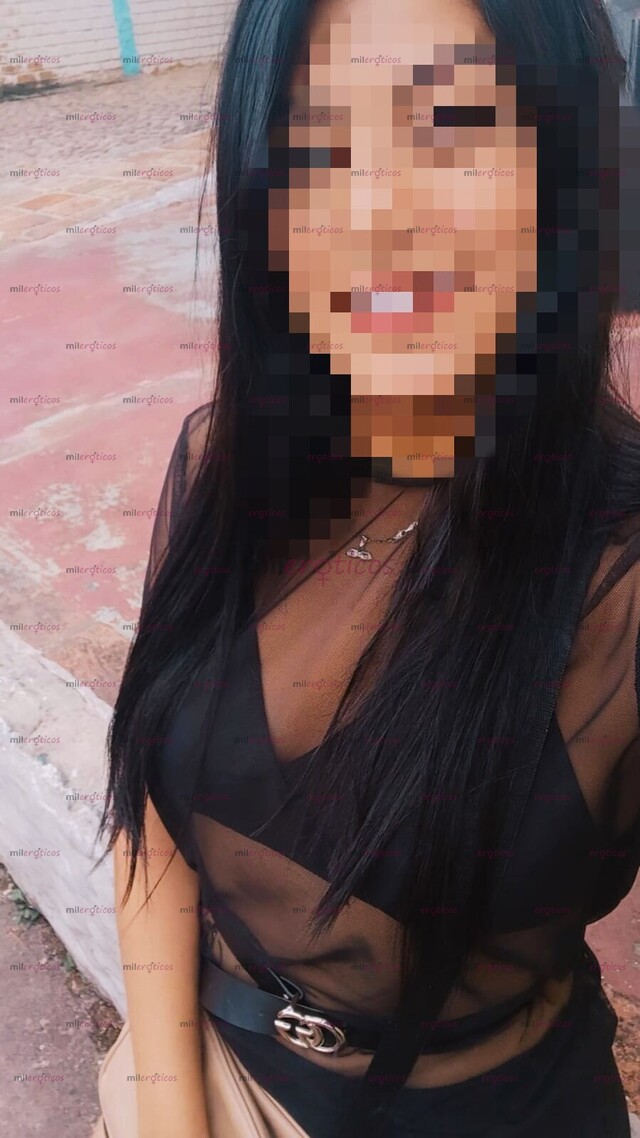 FOTOS DE PELI NEGRA NUEVA EN OCAÑA OPERADA ROSTRO ANGELICAL CN DISEÑO DE SONRISA
