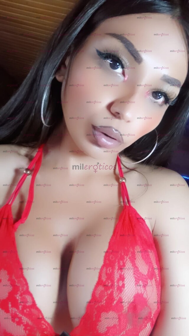 FOTOS DE PASIVA AV CHILE NUEVA VIRTUAL O RATO LENGUA BIFIDA