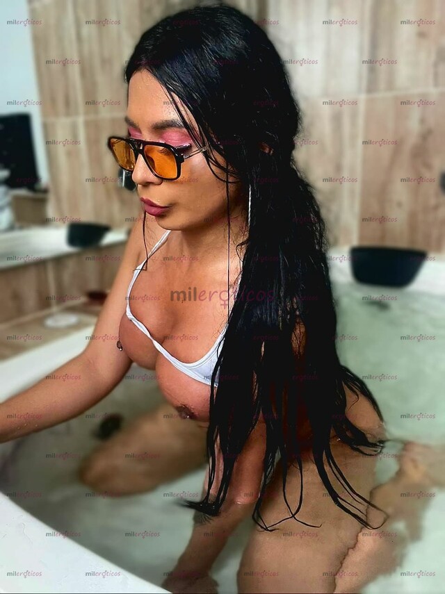 FOTOS DE CC MERCURIO SOACHA LENGUA BIFIDA PASIVA COMPLACIENTE