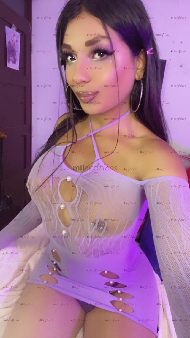 FOTOS DE CC MERCURIO SOACHA LENGUA BIFIDA PASIVA COMPLACIENTE