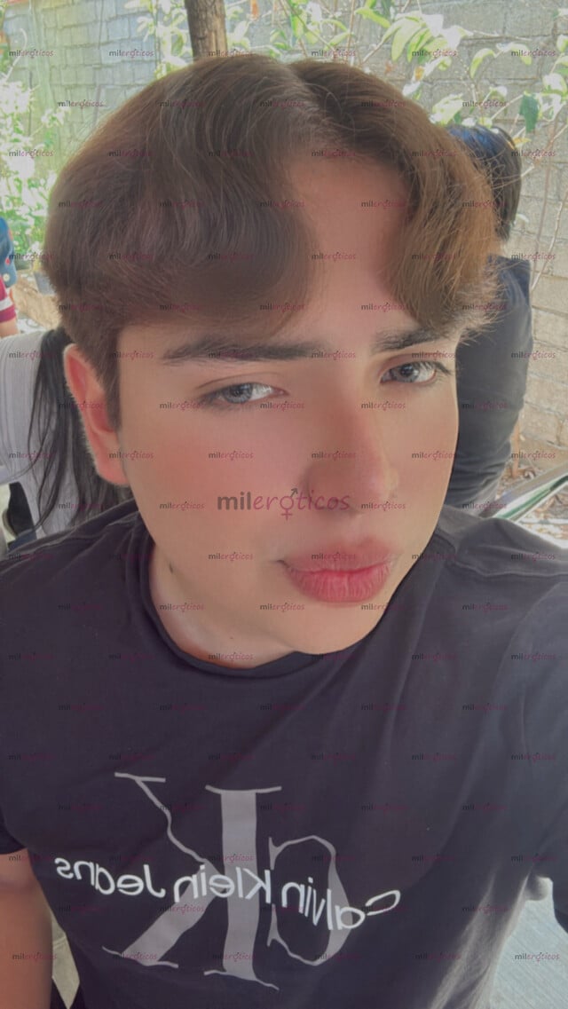 FOTOS DE NIÑO PIERNÓN DISPONIBLE SOLAMENTE EN OAXACA