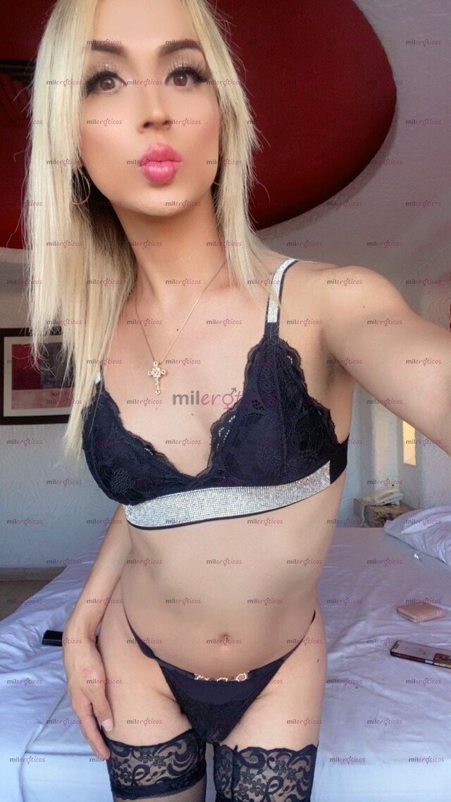 FOTOS DE KENZY ACEPTO PAGO CON TARJETA CULO RECIÉN OPERADO