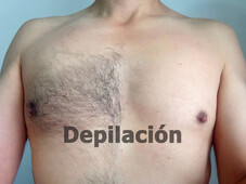 DEPILACIÓN, PARA MUJERES Y HOMBRES, NORTE BOGOTÁ, 3006305310 ESTETICISTA CARLOS - FOTO 8