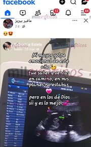 HERMOSA NIÑA DE ROSTRO ANGELICAL ,DE VISITA POR TU CIUDAD - FOTO 2