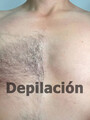 FOTOS DE DEPILACIÓN, PARA MUJERES Y HOMBRES, NORTE BOGOTÁ, 3006305310 ESTETICISTA CARLOS