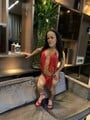 FOTOS DE LA PRIMERA ENANA TRANS BAJITA OPERADA EN COLOMBIA
