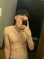 FOTOS DE JOVEN LLENO DE COLAGENO EN CDMX CON 18CM